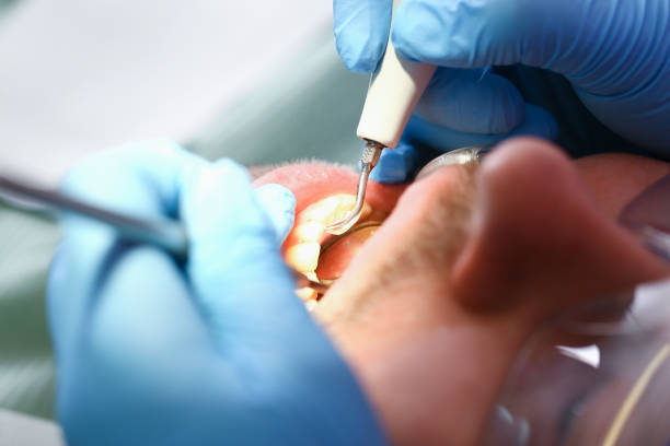 Best Dental Abscess Treatment in Fairview, OK